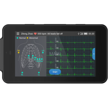Electrocardiographe de poche Pocket ECG 500 Lepu Médical avec interprétation