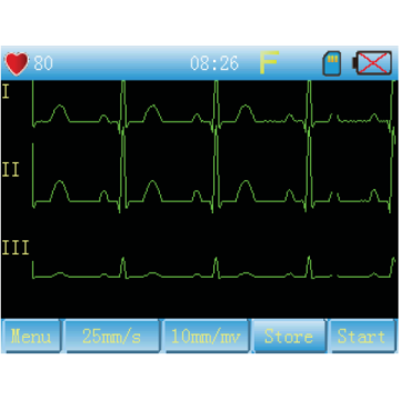 Electrocardiographe ECG Contec 90A (3 pistes) avec interprétation