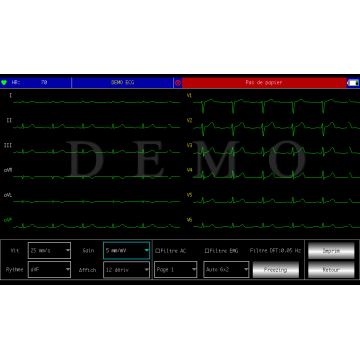 Electrocardiographe ECG Contec 600G (6 pistes) avec interprétation