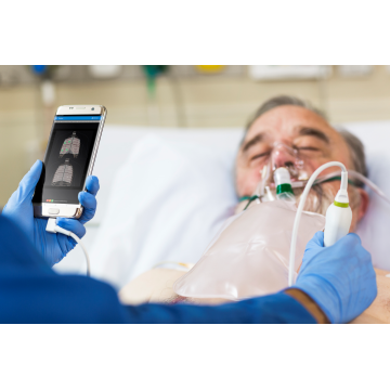 Dispositif d’échographie Philips Lumify pour Android