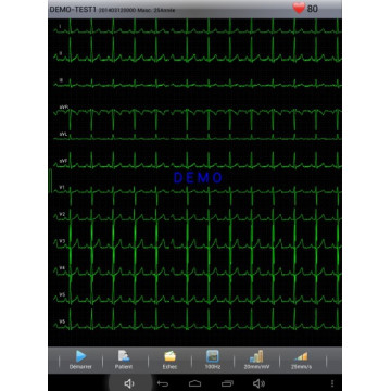 Electrocardiographe ECG Edan PADECG Numérique sans fil pour iPad avec interprétation